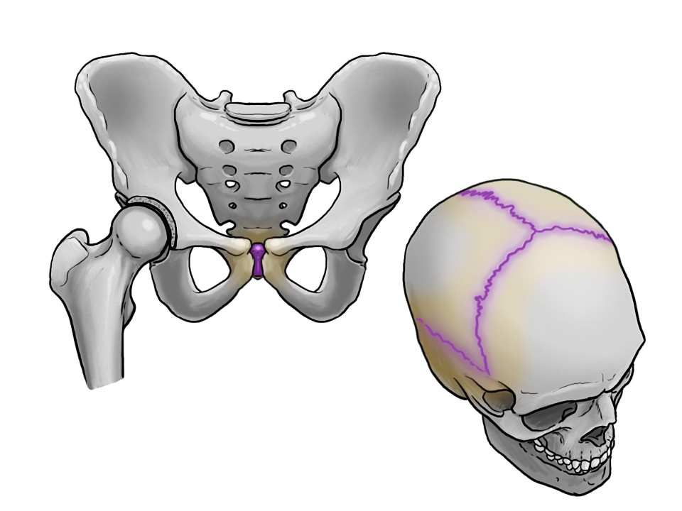 Hüfte und Schädel grafisch dargestellt, Schambeinfuge und Schädelnähte dabei markiert.