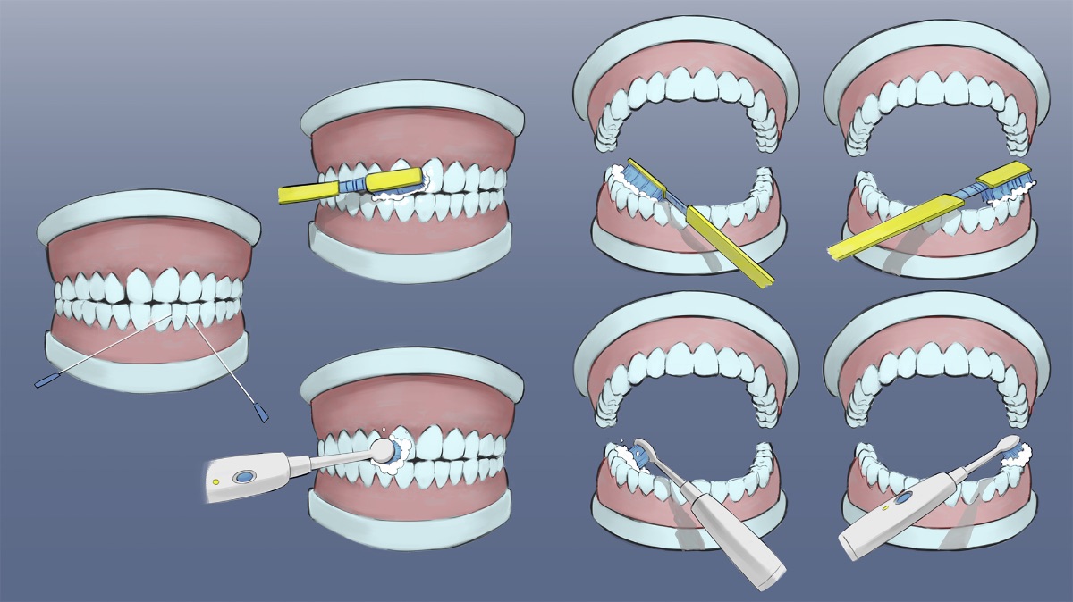 Zähneputzen mit einer elektrischen und einer Handzahnbürste