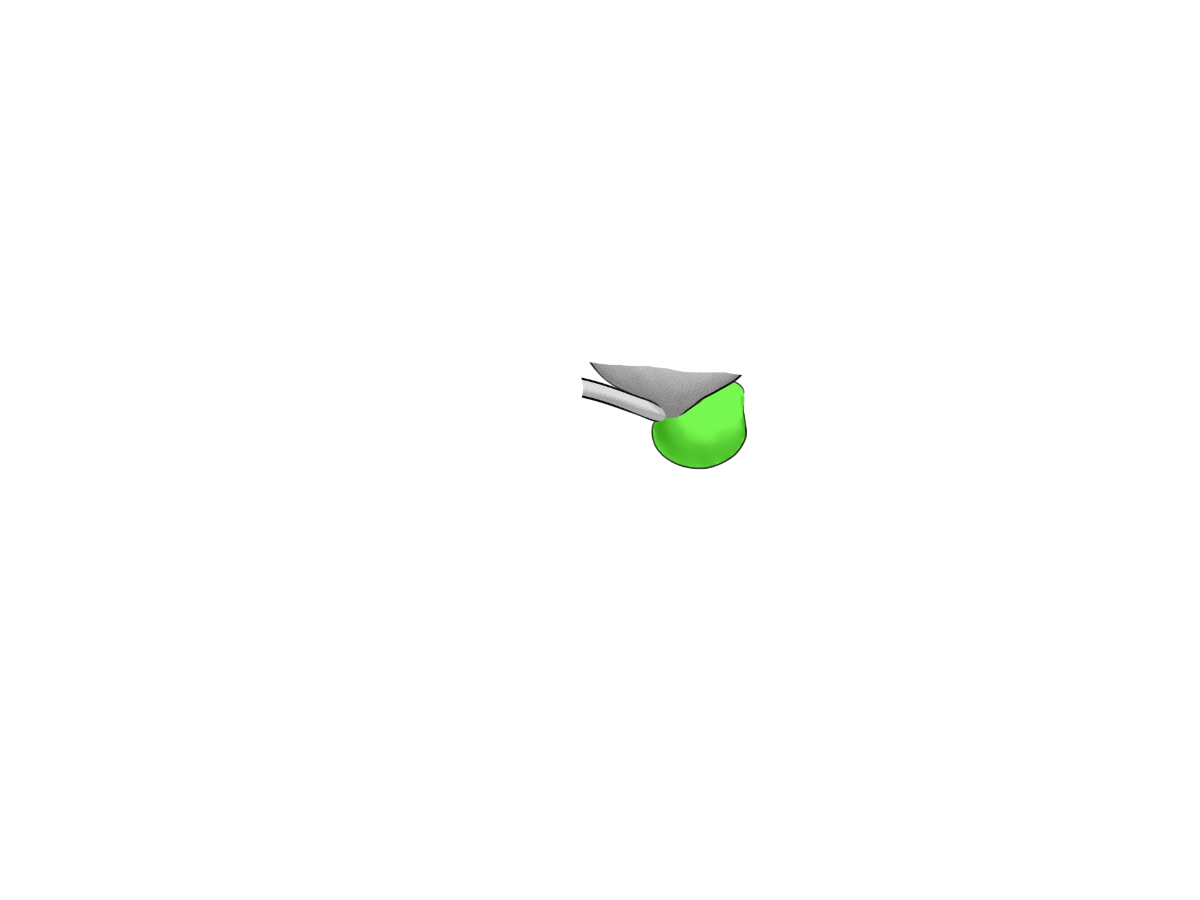 Netzmagen