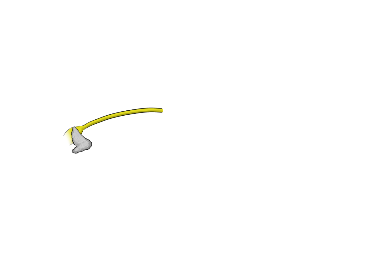 Speiseröhre