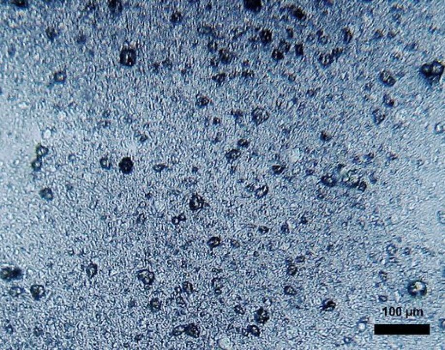 Mikroplastik aus Polyethen in Zahnpasta.